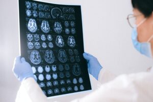How to See a Neurologist Without a Referral