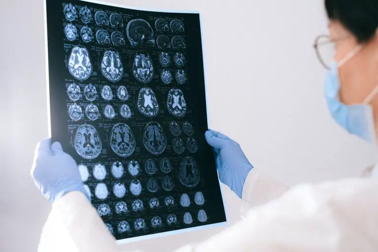 How to See a Neurologist Without a Referral
